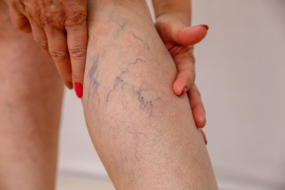 <strong><a href='diagnostico-de-arteritis-en-quito.php'><strong>Diagnóstico de arteritis</strong> en <strong>Quito</strong></a></strong>