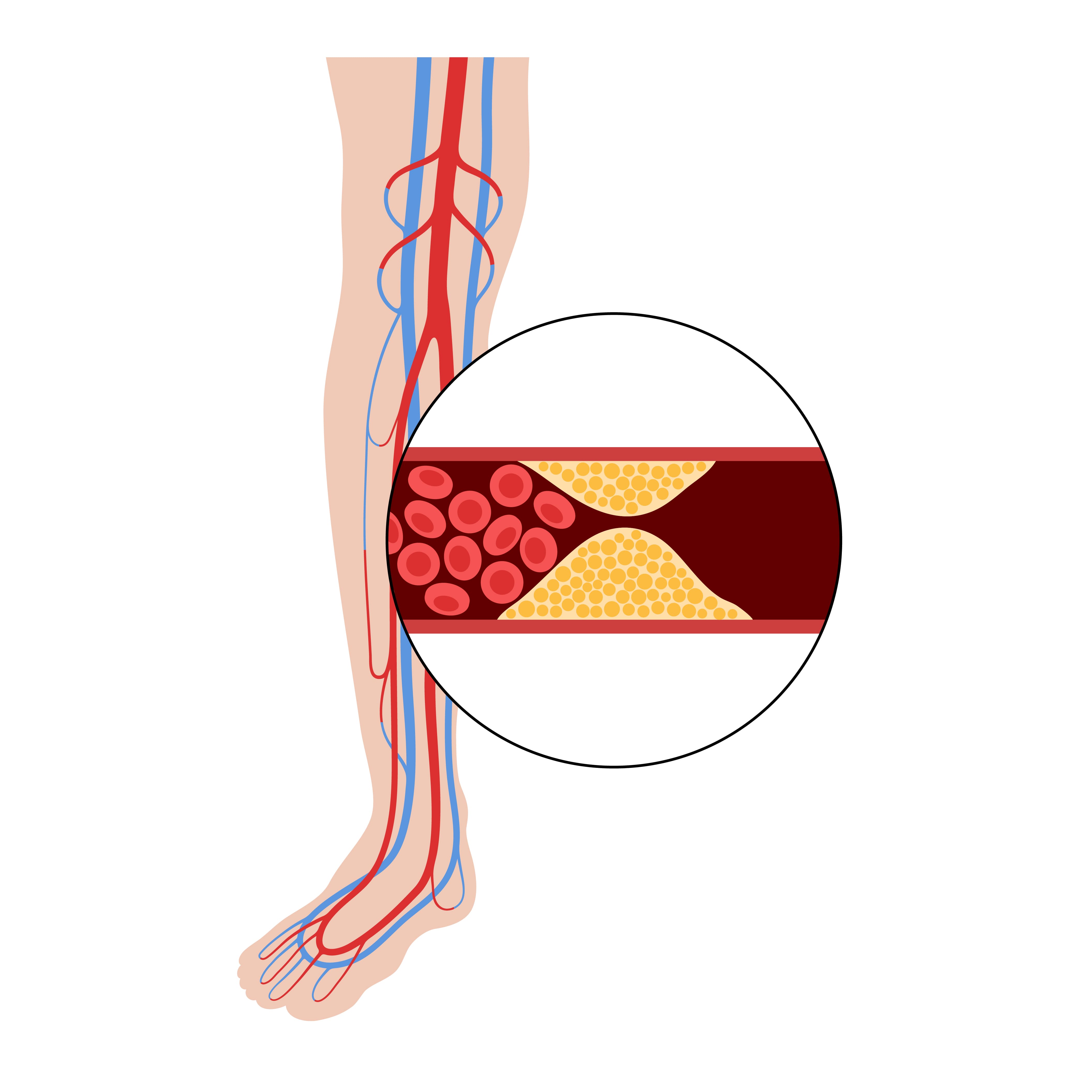 <strong><a href='especialista-en-aneurismas-arteriales.php'><strong>Especialista en aneurismas</strong> <strong>arteriales</strong></a></strong>