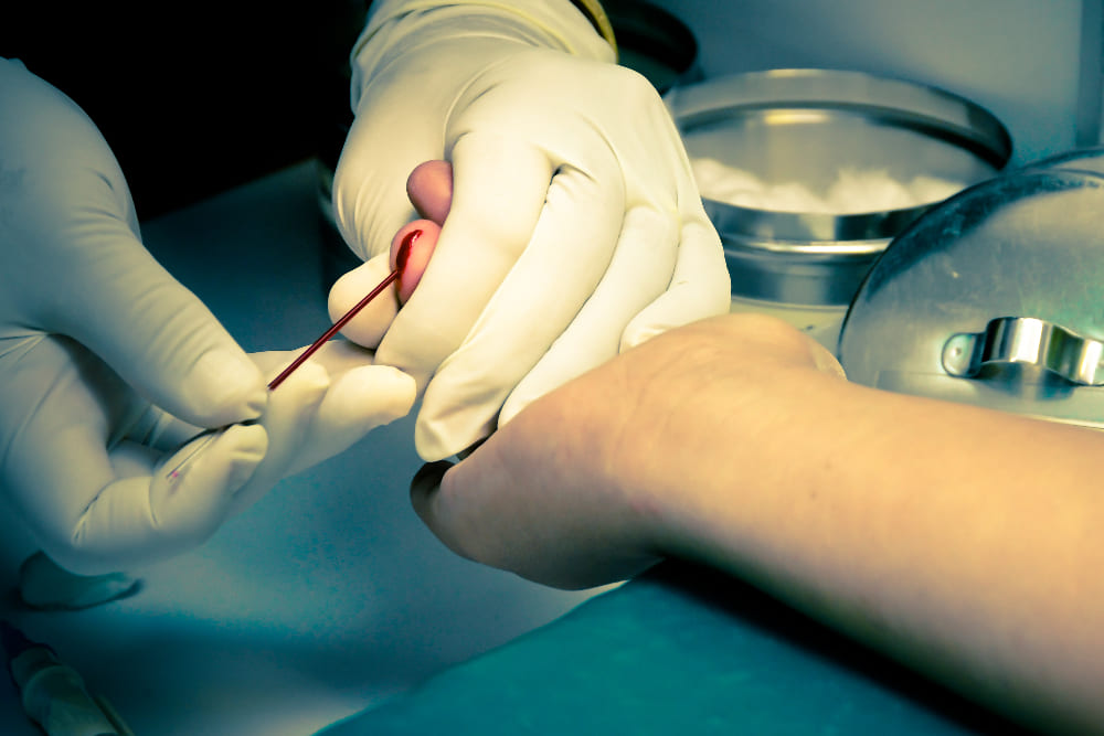 <strong><a href='procedimientos-de-angioplastia-periferica.php'><strong>Procedimientos de angioplastia</strong> <strong>periférica</strong></a></strong>