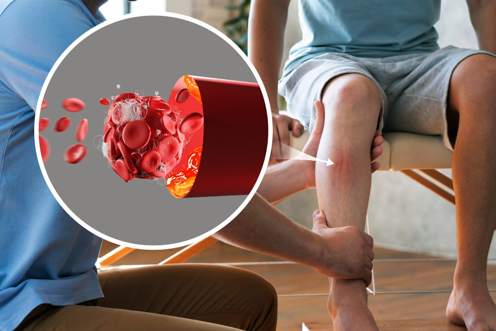 <strong><a href='terapia-para-insuficiencia-venosa-cronica.php'><strong>Terapia para insuficiencia</strong> <strong>venosa</strong> <strong>crónica</strong></a></strong>