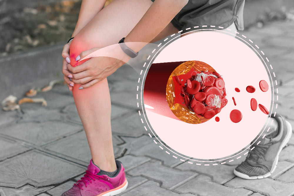 <strong><a href='tratamiento-de-ulceras-venosas-en-quito.php'><strong>Tratamiento de úlceras</strong> <strong>venosas en Quito</strong></a></strong>