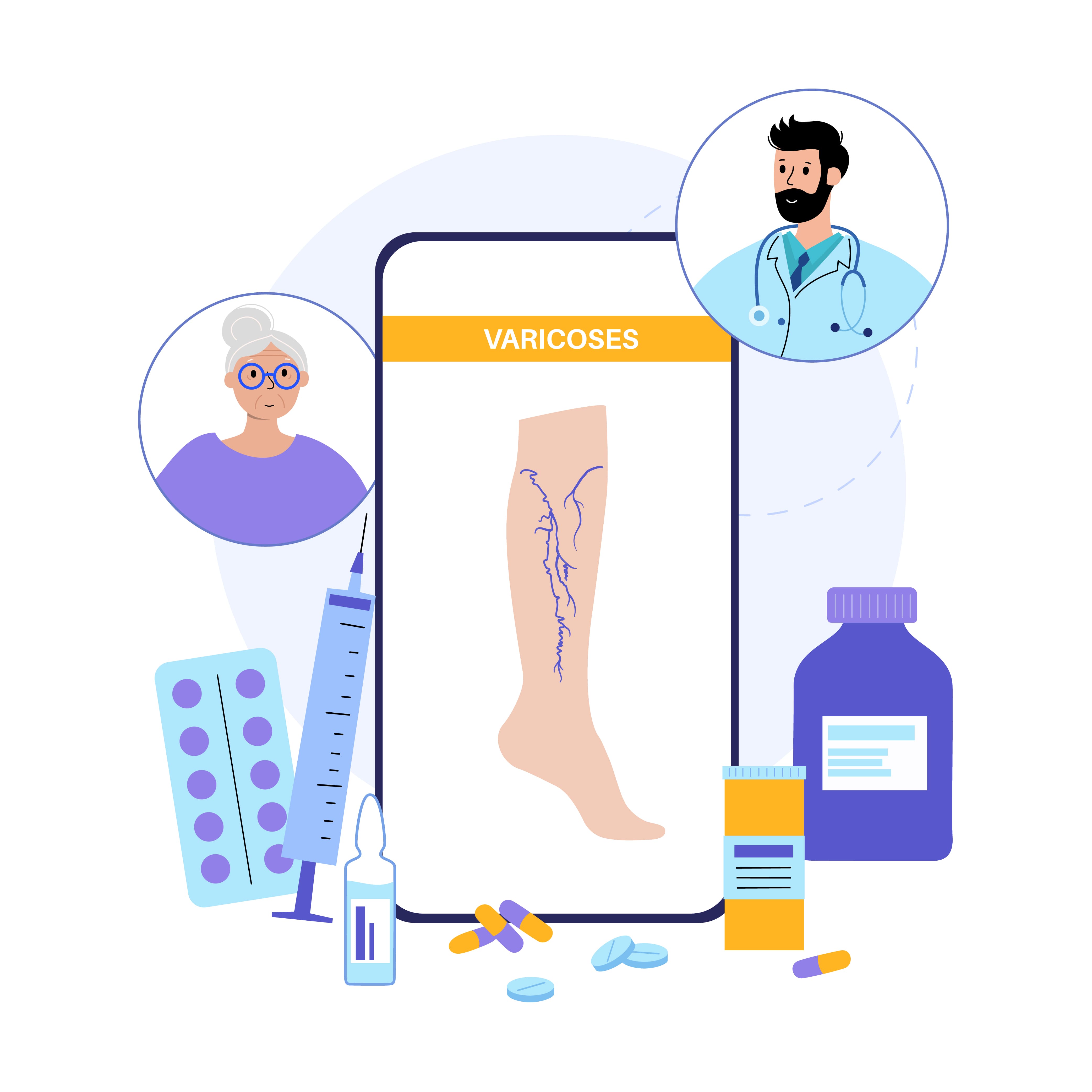 <strong>Tratamiento</strong> efectivo de <strong>várices</strong>
